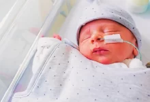 کمبود یا نرسیدن اکسیژن به مغز نوزاد