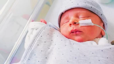 کمبود یا نرسیدن اکسیژن به مغز نوزاد